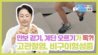 만보 걷기, 계단 오르기가 독?! 고관절염 비구이형성증