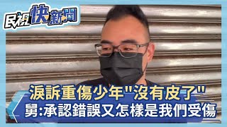 快新聞／淚訴竹北氣爆重傷少年「沒有皮了」　舅舅：你們承認錯誤又怎樣受傷的是我們－民視新聞