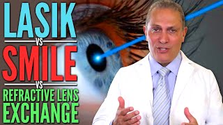 LASIK, SMILE or RLE - which is affordable and the safest eye surgery?