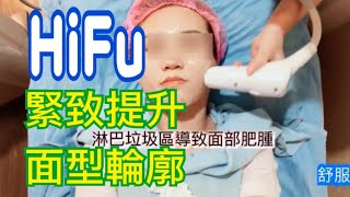 完美示範HiFu 提升面形輪廓