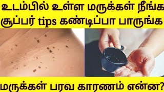 மருக்கள் நீங்க என்னசெய்ய வேண்டும்  in tamil|wart treatment in twothings tamil|Optical \u0026health vlogs