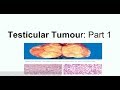 Seminoma: Clinical picture, Morphology and staging