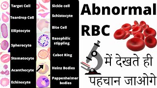 RBC Anomalies | RBC Abnormal Morphology | Inclusion bodies under microscope 🔬