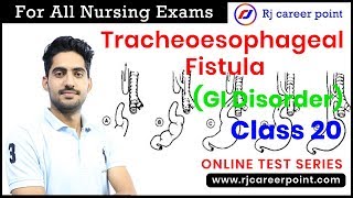 Tracheoesophageal  Fistula | Staff Nurse & Nursing Officer Online Classes | Rajesh gora