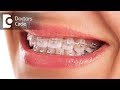 Do braces hurt? - Dr. Nandini Nelivigi