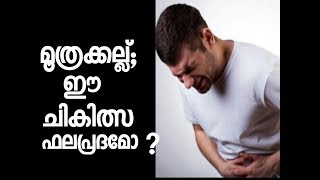 മൂത്രക്കല്ല്[ വൃക്കയിലെ കല്ല് ] പ്രധാന ലക്ഷണങ്ങളും കാരണങ്ങളും / kidney stone MALAYALAM Health Tips