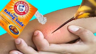 14 EFFECTIVE Home Remedies For Bee Stings | Natural Bee Sting Treatment
