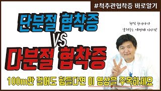 척추관협착증 바로알기 | 100m만 걸어도 쉬었다 가야 하는 원인은? (도침문의 010-9757-5178)