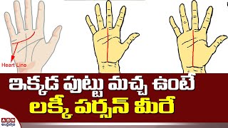 ఇక్కడ పుట్టు మచ్చ ఉంటే లక్కీ పర్సన్ మీరే | Does Palmistry Lines Affect Health? | Something Special