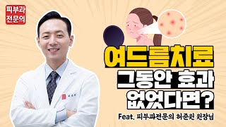 여드름치료 그동안 효과 없었다면? 정확한 진단부터! - 【feat. 피부과전문의】