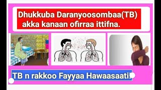 Dhukkuba Daranyoo sombaa(TB)