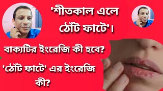 শীতকাল এলে ঠোঁট ফাটে (ইংরেজি অনুবাদ) /English Translation For Beginners.