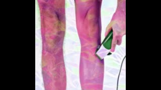 Full Body Hair Removal - Sapien MedIcine