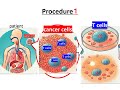 再　0106 g10 tumor infiltrating lymphocytes