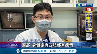 年僅2歲的孩童怎下得了手? 2歲男童疑遭虐死 母.同居人宿飯店急載童就醫 醫生: 四肢有瘀青 母稱\