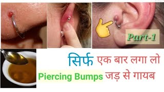 Piercing bumps गायब करने का आसान व घरेलू उपाय ll Home remedies for piercing bumps ll Piercing Tips l