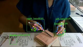 New Ai Teaches Surgeons