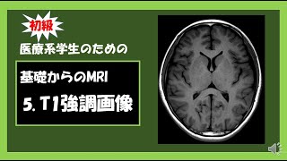 【MRI基礎】5.  T1強調画像