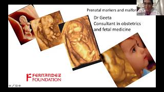 Prenatal Markers and malformations by Dr. Geeta Kolar
