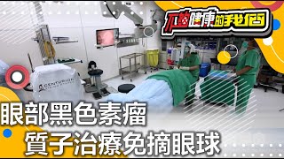 眼部黑色素瘤 質子治療免摘眼球 | 醫療科技 | 不夠健康的我們 |  @GTV健康NO.1