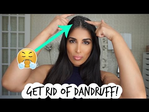 HAIR HACK! GET RID OF DANDRUFF FAST! HAIR HACK! GET RID OF DANDRUFF FAST!