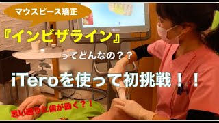 [話題沸騰!]マウスピース矯正！インビザライン！iTeroを使ってみた！