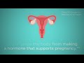 What is abortion?