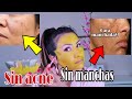 COMO ELIMINAR MANCHAS  en la CARA , aclarar  melasma, para una piel sin manchas, sin  ANÉ