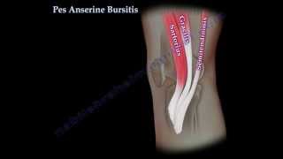 Pes Anserine Bursitis , knee pain  - Everything You Need To Know - Dr. Nabil Ebraheim