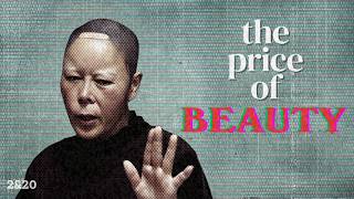 Why Plastic Surgery Is Destroying Korea