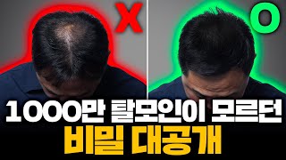 아직도 몰랐어?1000만 탈모인이 모르던 비밀 대공개!!