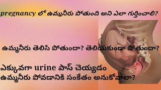 ఉమ్మనీరు లీక్ అవుతుంది అని ఎలా గుర్తించాలి?how to know the leakage of amniotic fluid telugu?