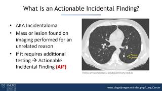 Managing Incidental Findings