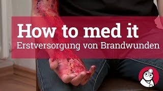 How to med it - Erstversorgung von Brandwunden