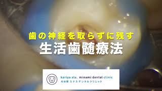 歯の神経を取らずに残す　【愛知県刈谷市の歯医者】　生活歯髄療法　オンライン診療　バイオセラミックス　自由診療　顕微鏡歯科　マイクロスコープ　Vital Pulp Therapy　Kariya city