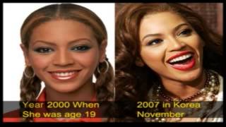 Beyonce plastic surgery The Truth #beyonce