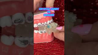 Are crunchy CRYSTAL CANDIES safe for BRACES? (ASMR eating) #shorts #asmr #braces