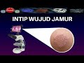 ZOOM BERBAGAI JAMUR DENGAN MIKROSKOP ELEKTRON/FUNGUS UNDER MICROSCOPE - DIRGA BIOLOGY CHANNEL