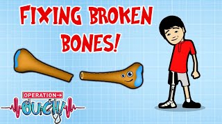 Fixing Broken Bones With Bioglass! 🦴 | Science for Kids | Operation Ouch