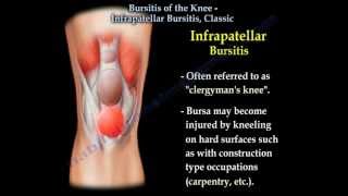 Knee Bursitis Infrapatellar Bursitis Classic - Everything You Need To Know - Dr. Nabil Ebraheim