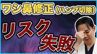 【鼻整形】ワシ鼻修正（ハンプ切除）のリスク失敗｜鼻筋がへこんでしまう？