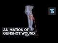 Animation of gunshot wound