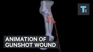 Animation of gunshot wound