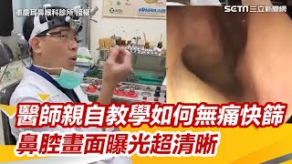 醫師親自教學如何無痛快篩！鼻腔畫面曝光超清晰【94要客訴】