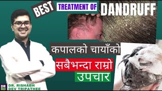 कपालको चाया कसरी हटाउने | Chaya ko Upachar| Dandruff Kasari Hataune [ Best Dandruff Treatment]|