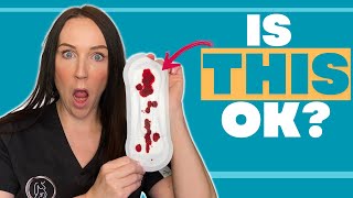 In Your First Trimester Of Pregnancy? A MUST WATCH (Bleeding In Early Pregnancy)