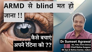 बढ़ती उम्र की (RETINA) पर्दे की बीमारी. जानिये ARMD हुआ तो क्या करें ??