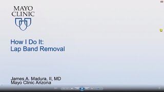 How I Do It: Lap Band Removal by James A. Madura, II, MD | Preview