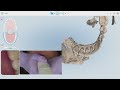 how to pre treatment scan lower arch for beginners