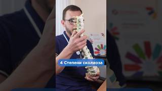 4 степени сколиоза #shorts #сколиоз #осанка